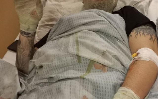 Pomohli jste přispět na rehabilitační pobyty pro ukrajinské veterány